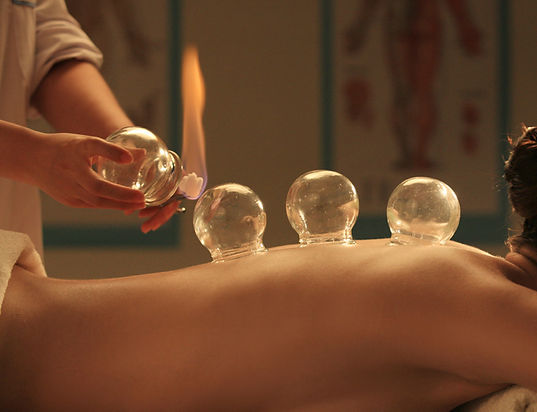Cupping therapy in the treatment room